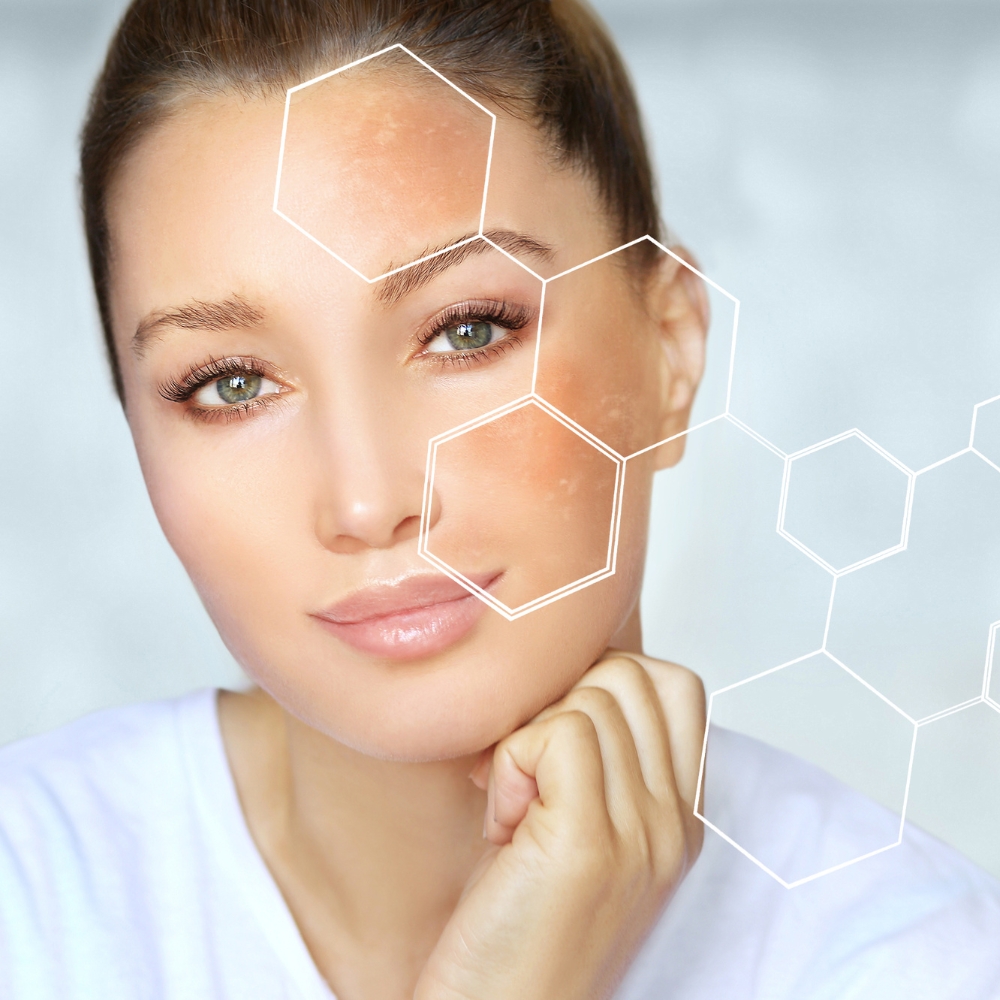 Skin Nutraceuticals